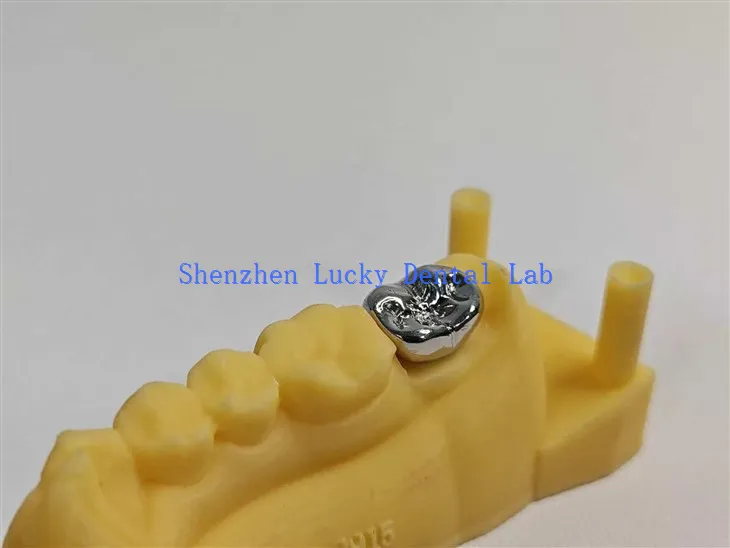 Print 3D Coron Metel Llawn FMC Deintyddol Uchel