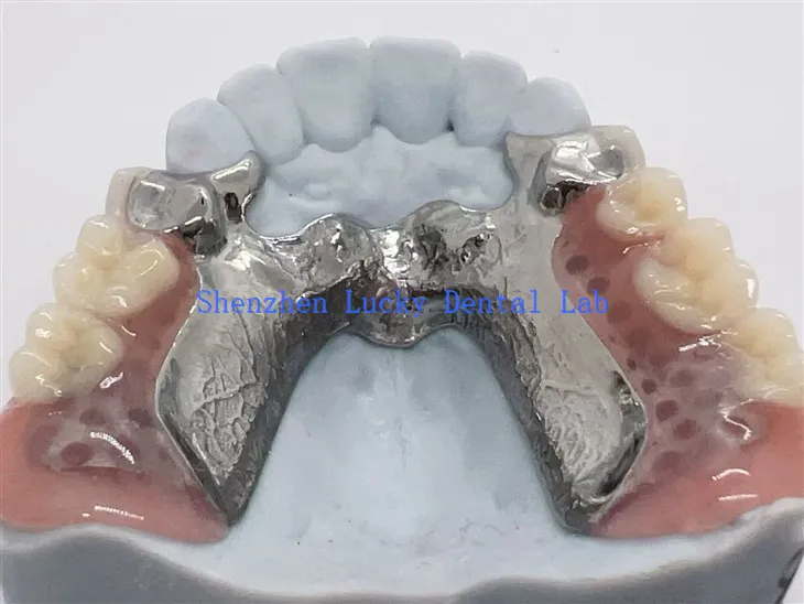 Fframwaith Aloi Titaniwm Argraffu 3D