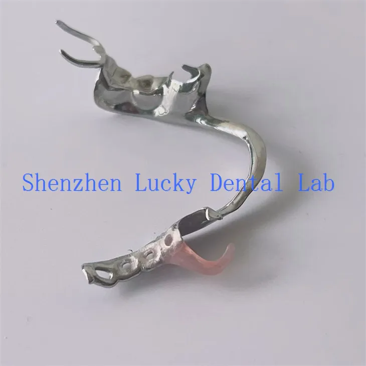 Fframwaith metel deintyddol clasp valplast esthetig wedi'i wneud yn Tsieina