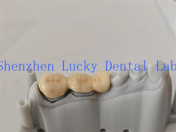 China 3D Print Zirconia a Die Dental Lab