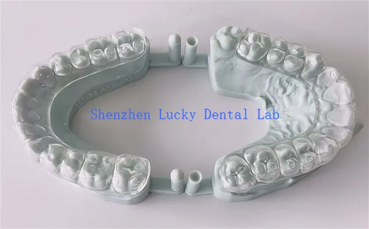 Print 3D cyfforddus gweithgynhyrchwyr gwarchod nos caled