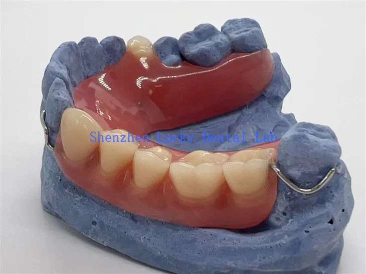 Dannedd gosod acrylig rhannol cyfforddus gyda clasp gwifren