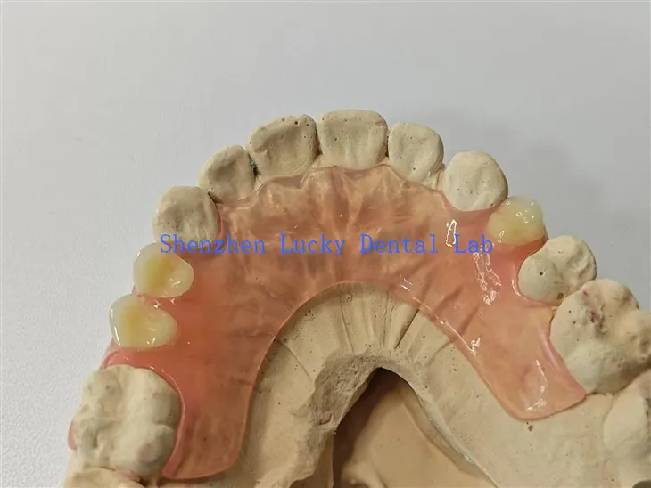 Labordy deintyddol dannedd gosod hyblyg cyfforddus