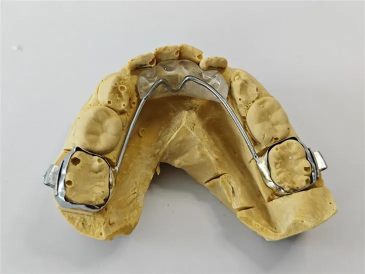 Awyren brathiad anterior deintyddol