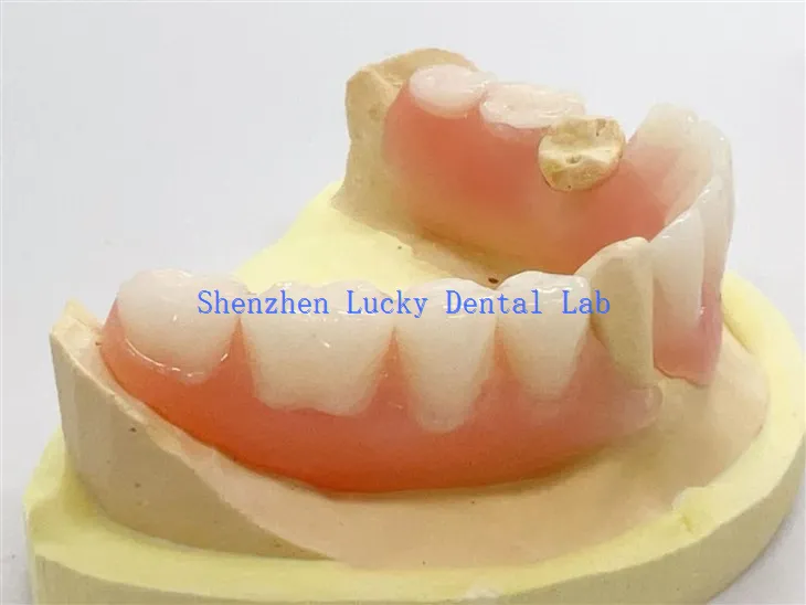 Dannedd gosod hyblyg rhannol deintyddol o ansawdd uchel