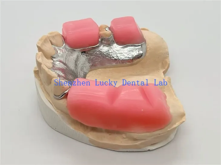 Ffrâm Metel Gyda Bloc Brathu