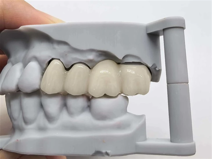 Labordy Deintyddol Pont Zirconia Tsieina